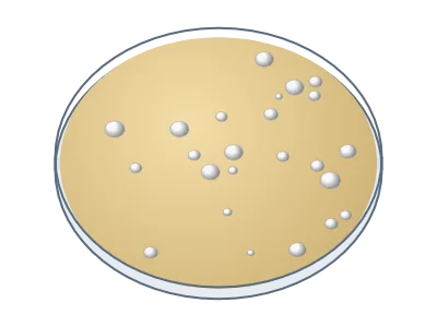Petri dish: Culture dish with agar and colonies, seen from above or at an angle